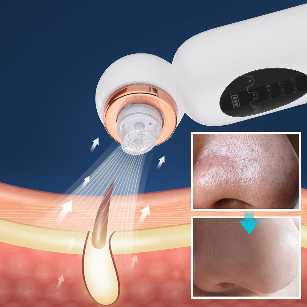 Hydro facial device applying circular suction nozzle to nose skin; inset shows clearer pores
